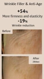 Máscara Wrinkle Filler & Anti-Age (pack 5) - Image 2